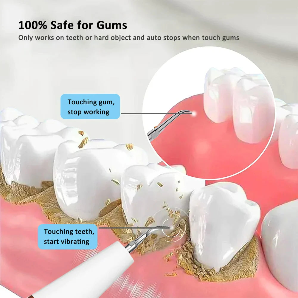 SmileBright Pro - Ultraschall-Zahnreiniger