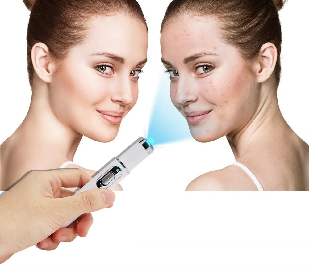 Blaulichttherapie-Stift für Besenreiser