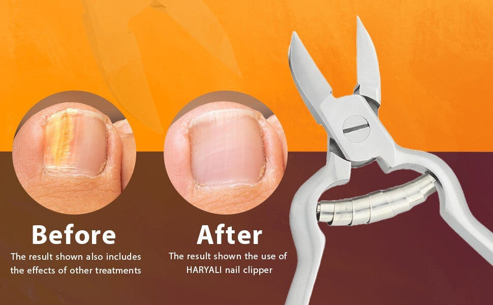 SureSnip Steel - Nagelknipser für dicke Nägel