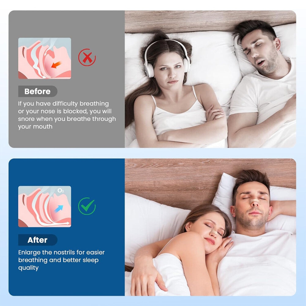 AirPath Strips - Anti-Schnarch-Nasenstrips