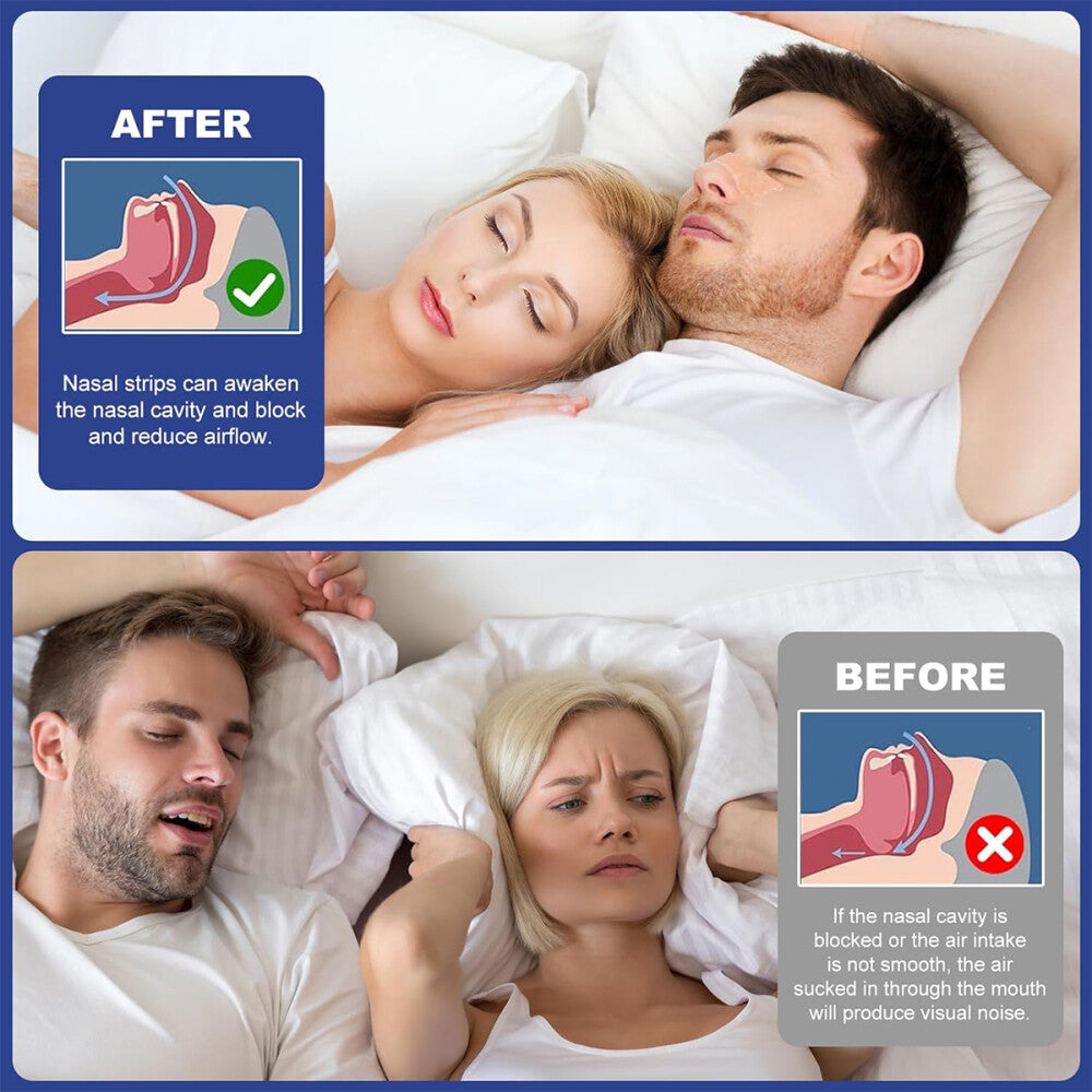 AirPath Strips - Anti-Schnarch-Nasenstrips