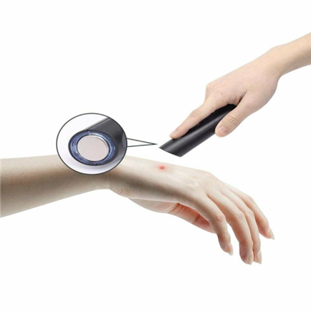 HushZap - Gerät zur Linderung von Mückenstichen