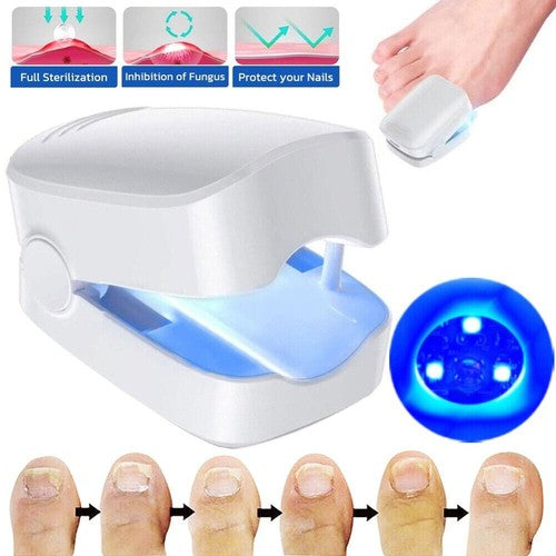 NailPure Beam – Nagelpilz-Behandlungslicht